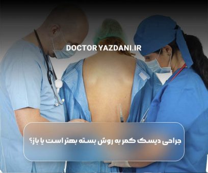 جراحی دیسک کمر به روش بسته بهتر است یا باز؟